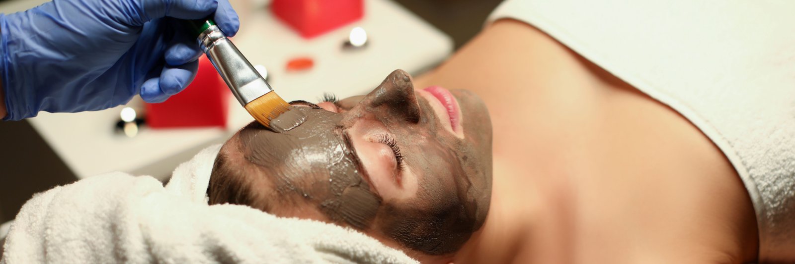 Chemical Peeling